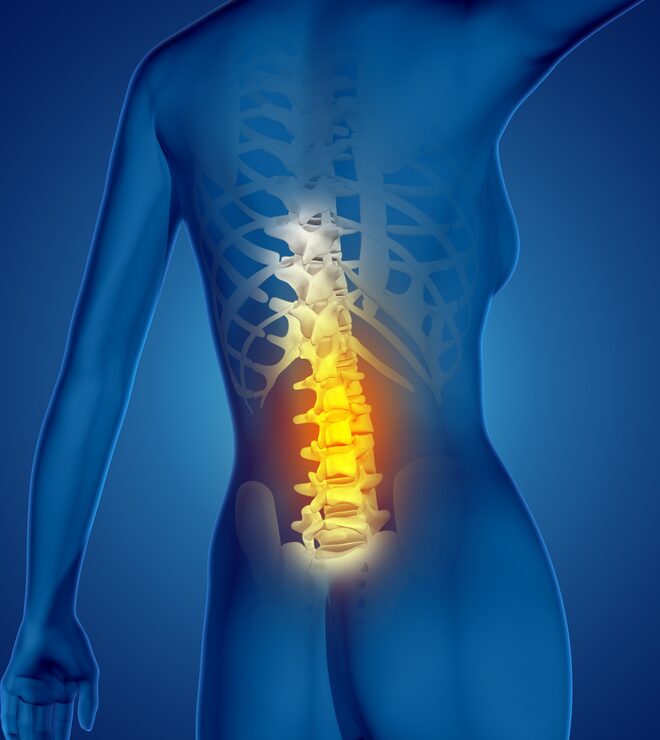 Back Pain