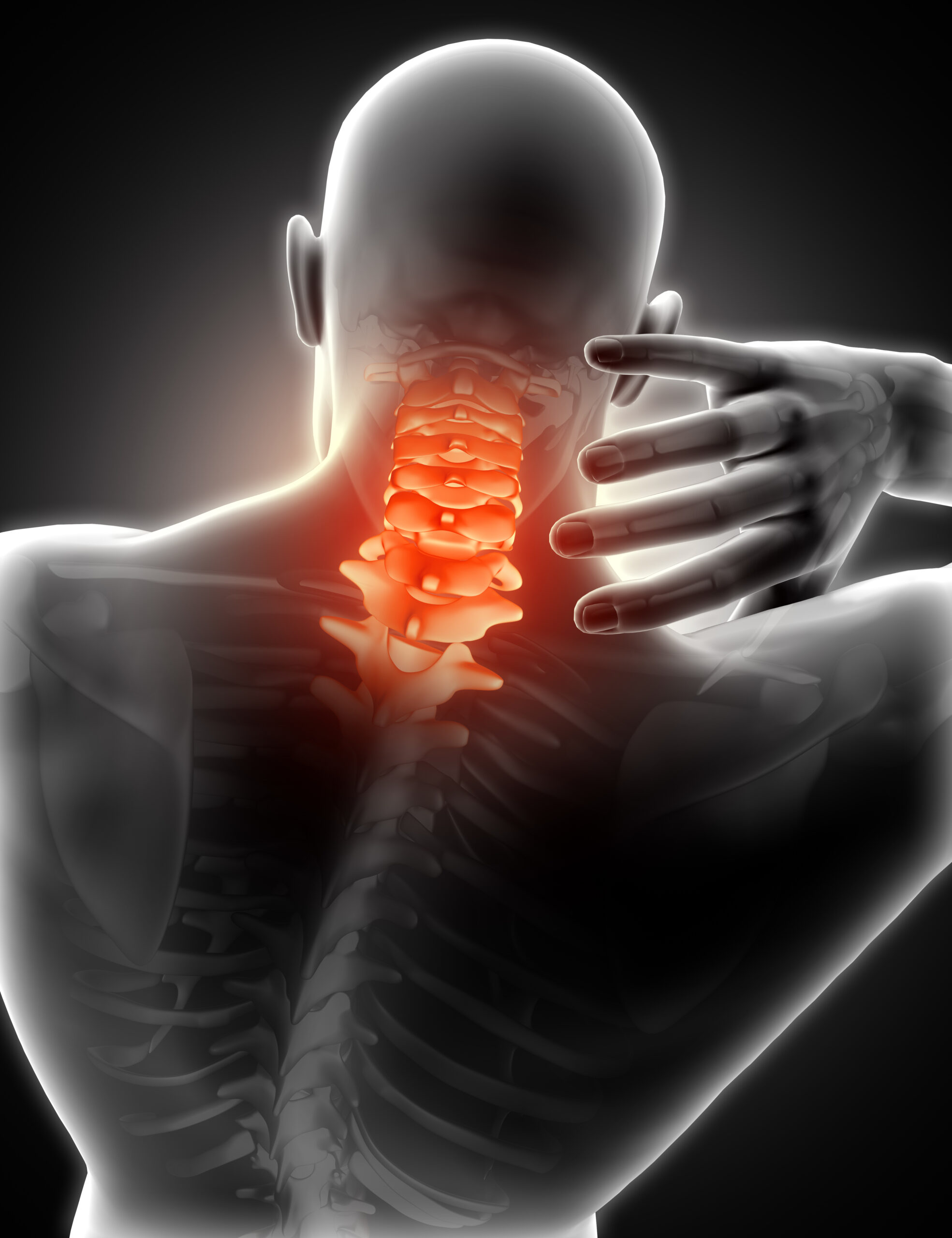 Neck Pain Physiotherapy